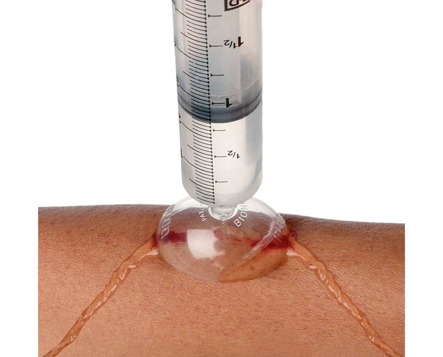 Module 2 - Irrigation & Wound Prep