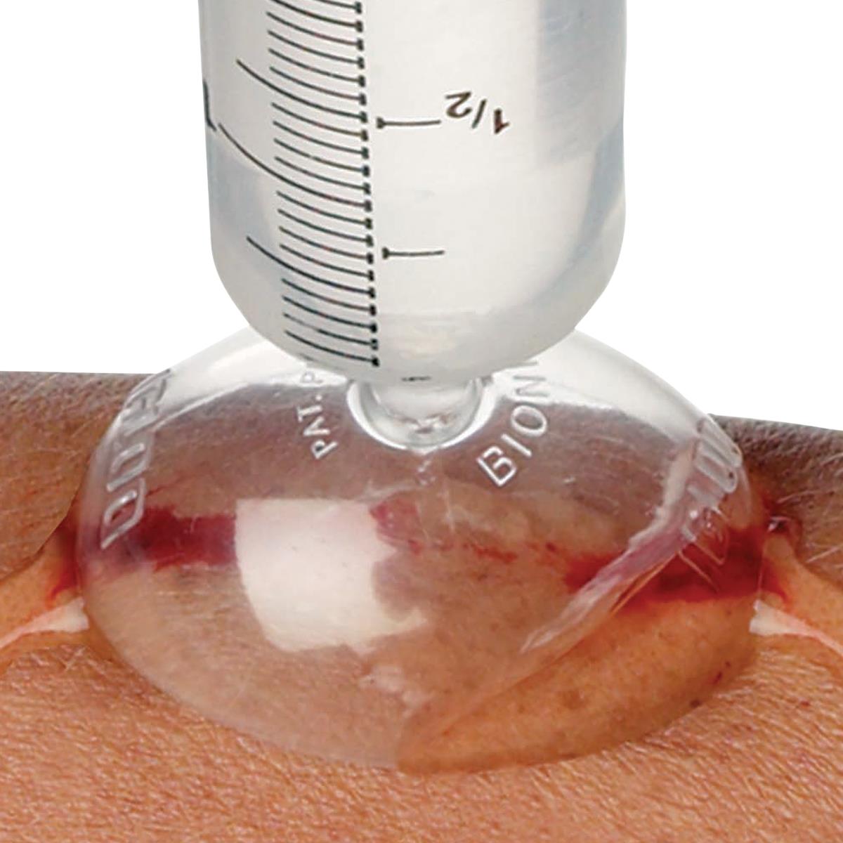 Module 2 - Irrigation & Wound Prep